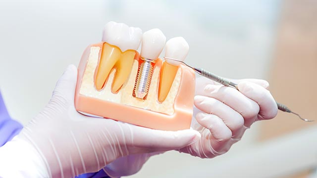 Anne Eckhoff, DMD | Invisalign reg , Night Guards and Extractions