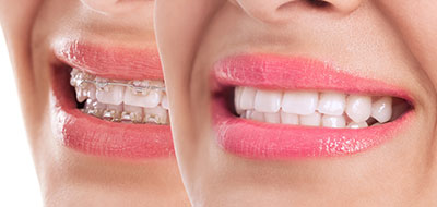 Anne Eckhoff, DMD | Dental Fillings, Night Guards and Implant Dentistry