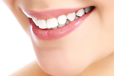 Anne Eckhoff, DMD | Dental Cleanings, Invisalign reg  and Dental Bridges