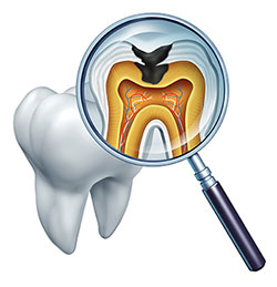Anne Eckhoff, DMD | Invisalign reg , Dental Bridges and Teeth Whitening