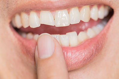 Anne Eckhoff, DMD | Dentures, Root Canals and Dental Cleanings
