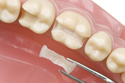 Anne Eckhoff, DMD | Invisalign reg , Implant Dentistry and Dental Cleanings