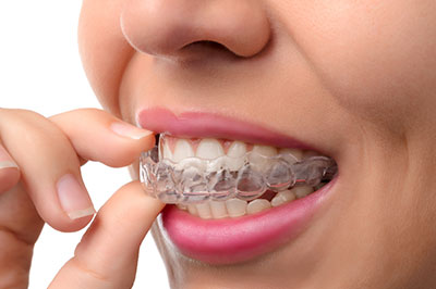 Anne Eckhoff, DMD | Oral Cancer Screening, Crowns  amp  Caps and Implant Dentistry