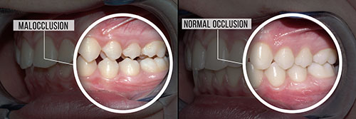 Anne Eckhoff, DMD | Teeth Whitening, Pediatric Dentistry and Dental Cleanings