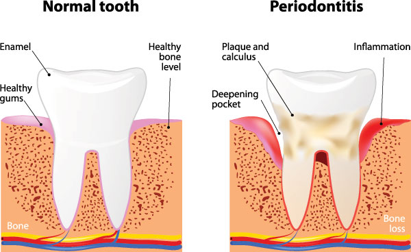 Anne Eckhoff, DMD | Veneers, Oral Exams and Cosmetic Dentistry