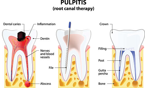 Anne Eckhoff, DMD | Oral Exams, Root Canals and Dental Cleanings